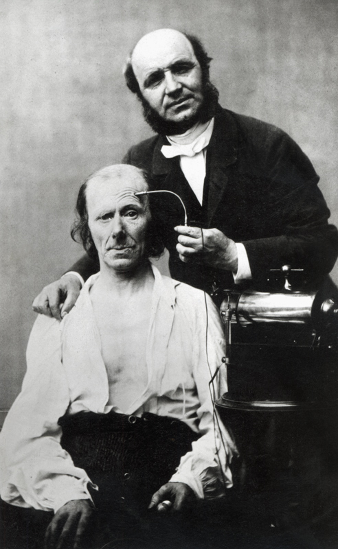 Duchenne de Boulogne with a ''victim patient'', 1862 (b/w photo)  from French Photographer